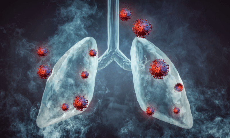 bronquitis