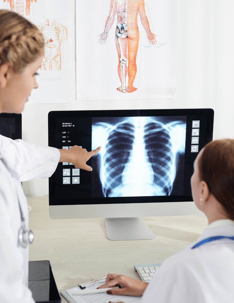 rayos de pulmones